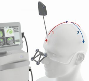 NEUROLITH - BodyTrack-System - Kopf vermessen - Neuroinstitut München